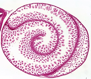 Spiral intestine morphogenesis in the little skate.