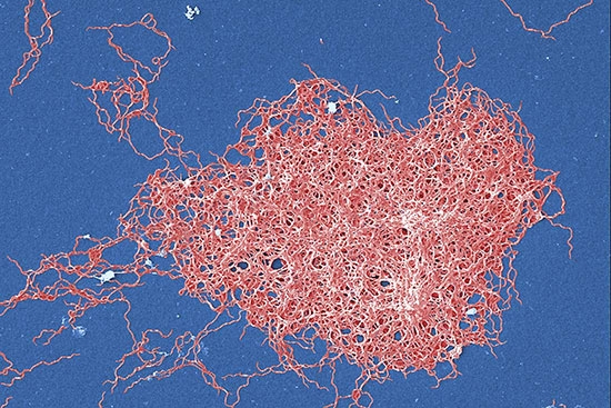 This digitally colorized scanning electron micrograph depicts a grouping of numerous Gramnegative, anaerobic, Borrelia burgdorferi bacteria, which cause Lyme disease. 