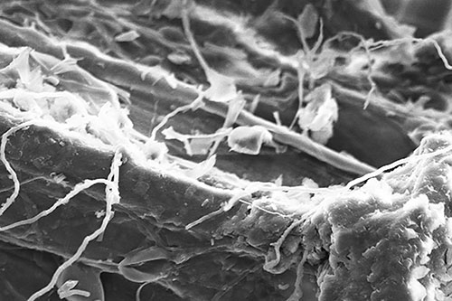 Mycelia, as seen with a scanning electron microscope