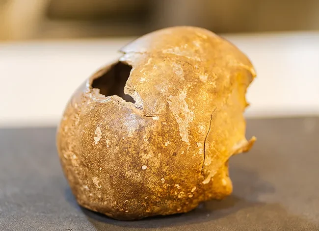 A partial human skull believed to belong to a victim of the Schenectady Massacre, which took place Feb. 8, 1690. Unearthed during an excavation in a downtown area in the 19th century, the skull was gifted to the College in 1877.
