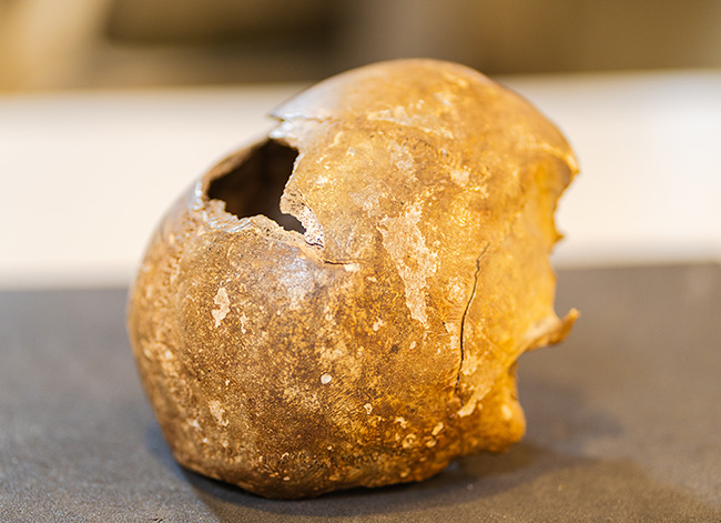 A partial human skull believed to belong to a victim of the Schenectady Massacre, which took place Feb. 8, 1690. Unearthed during an excavation in a downtown area in the 19th century, the skull was gifted to the College in 1877.