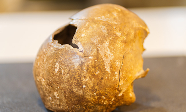 A partial human skull believed to belong to a victim of the Schenectady Massacre, which took place Feb. 8, 1690. Unearthed during an excavation in a downtown area in the 19th century, the skull was gifted to the College in 1877.